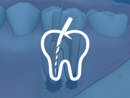 Endodonti (Kanal Tedavisi)